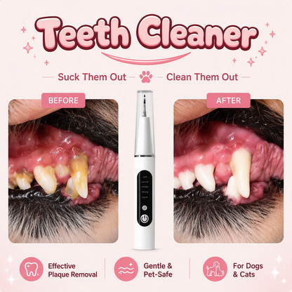 DYNACY® Teeth Cleaner